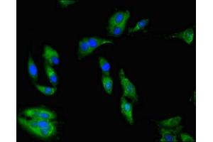 Immunofluorescent analysis of Hela cells using ABIN7142675 at dilution of 1:100 and Alexa Fluor 488-congugated AffiniPure Goat Anti-Rabbit IgG(H+L)