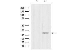 anti-Insulin Induced Gene 1 (INSIG1) (Internal Region) antibody