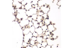 Immunohistochemistry of paraffin-embedded rat lung using VRK1 antibody (ABIN5975628) at dilution of 1/100 (40x lens).