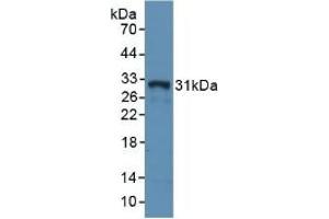 Detection of Recombinant MHCDRa, Rabbit using Polyclonal Antibody to HLA Class II Histocompatibility Antigen, DR Alpha Chain (HLA-DRA) (HLA-DRA anticorps  (AA 26-221))
