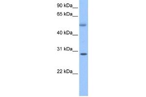 WB Suggested Anti-C17orf81 Antibody Titration: 0. (Retinoic Acid Induced 12 (RAI12) (C-Term) anticorps)