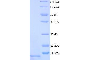 SDS-PAGE (SDS) image for Apolipoprotein C-II (APOC2) (AA 23-101) protein (His tag) (ABIN5713242)