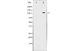 Western blot analysis of PDGFR beta expression in H2O2 treated LOVO whole cell lysates,The lane on the left is treated with the antigen-specific peptide. (PDGFRB anticorps  (C-Term))
