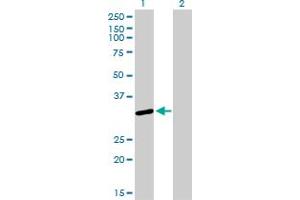 Western Blot analysis of SNRPA expression in transfected 293T cell line by SNRPA monoclonal antibody (M01), clone 3F9-1F7.
