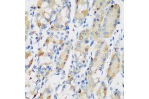 Immunohistochemistry of paraffin-embedded human stomach using RRM1 antibody.
