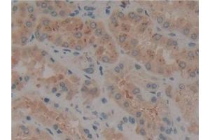 Detection of Flt3 in Human Kidney Tissue using Polyclonal Antibody to FMS Like Tyrosine Kinase 3 (Flt3)