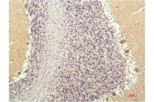 Immunohistochemical analysis of paraffin-embedded Human Brain Tissue using SGK1 Mouse mAb diluted at 1:200. (SGK1 anticorps  (AA 350-430))