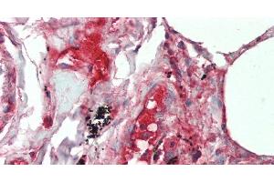 Immunohistochemistry of paraffin-embedded Lung tissue using IL19 Polyclonal Antibody at dilution of 1:90 . (IL-19 anticorps)