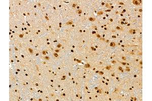ABIN6255320 and ABIN6267014 at 1/100 staining Rat brain tissue by IHC-P.