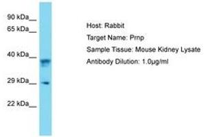 Image no. 1 for anti-Prion Protein (PRNP) (AA 91-140) antibody (ABIN6750495) (PRNP anticorps  (AA 91-140))