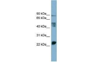 WB Suggested Anti-MPZL1  Antibody Titration: 0. (MPZL1 anticorps  (Middle Region))