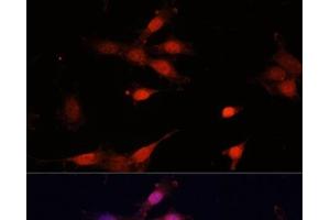 Immunofluorescence analysis of NIH-3T3 cells using Bcl-2 Polyclonal Antibody at dilution of 1:100 (40x lens). (Bcl-2 anticorps)