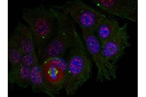 Image no. 1 for anti-Myocyte Enhancer Factor 2A (MEF2A) (pThr319) antibody (ABIN401543) (MEF2A anticorps  (pThr319))