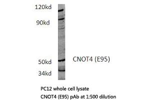 Western blot (WB) analysis of CNOT4 antibody in extracts from PC12 cells. (CNOT4 anticorps)