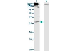 Western Blot analysis of RICTOR expression in transfected 293T cell line by RICTOR monoclonal antibody (M01), clone 1F3. (RICTOR anticorps  (AA 1-98))