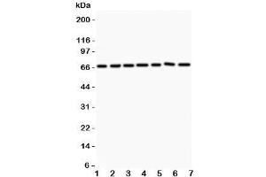 Western blot testing of ANG1 antibody and Lane 1:  HeLa;  2: MCF-7;  3: COLO320;  4: A549;  5: HEPG2;  6: 293T;  7: SW620. (Angiopoietin 1 anticorps  (AA 16-350))