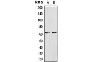 Western blot analysis of Glucagon Receptor expression in PC12 (A), Jurkat (B) whole cell lysates. (Glucagon Receptor anticorps  (Center))