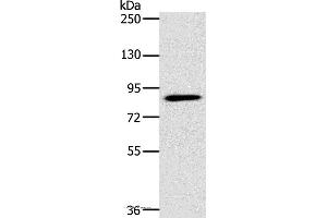 Western blot analysis of 293T cell, using PLEKHG6 Polyclonal Antibody at dilution of 1:400 (PLEKHG6 anticorps)
