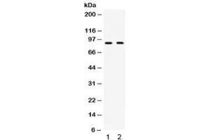 Western blot testing of 1) mouse testis and 2) human HeLa lysate with CIP2A antibody. (KIAA1524 anticorps)