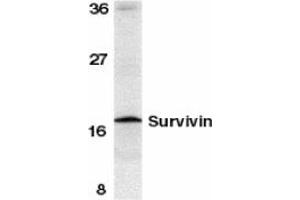 Image no. 1 for anti-Baculoviral IAP Repeat-Containing 5 (BIRC5) (C-Term) antibody (ABIN204355) (Survivin anticorps  (C-Term))
