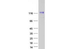 Validation with Western Blot