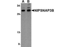 Western Blotting (WB) image for anti-Nipsnap Homolog 3B (NIPSNAP3B) (Middle Region) antibody (ABIN1031018) (NIPSNAP3B anticorps  (Middle Region))