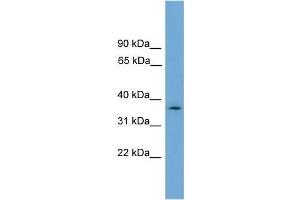 Human U937; WB Suggested Anti-NUBP1 Antibody Titration: 0. (NUBP1 anticorps  (N-Term))