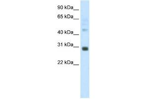 WB Suggested Anti-DLX5 Antibody Titration:  1. (DLX5 anticorps  (C-Term))