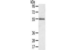 Gel: 8 % SDS-PAGE,Lysate: 40 μg,Primary antibody: ABIN7192490(SLC43A2 Antibody) at dilution 1/200 dilution,Secondary antibody: Goat anti rabbit IgG at 1/8000 dilution,Exposure time: 1 minute (SLC43A2 anticorps)