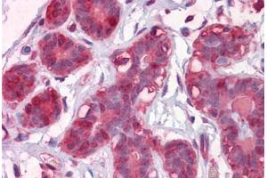 Human Breast: Formalin-Fixed, Paraffin-Embedded (FFPE)