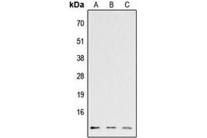 Western blot analysis of CCL26 expression in HEK293T (A), Raw264. (CCL26 anticorps  (Center))