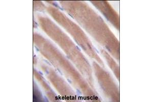 VEGF3 Antibody immunohistochemistry analysis in formalin fixed and paraffin embedded human skeletal muscle followed by peroxidase conjugation of the secondary antibody and DAB staining.