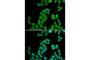 Immunofluorescence analysis of MCF-7 cell using RNASE13 antibody. (RNASE13 anticorps)