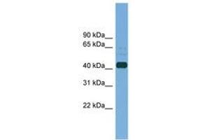 Image no. 1 for anti-Plasminogen Activator, Tissue (PLAT) (AA 323-372) antibody (ABIN6745203) (PLAT anticorps  (AA 323-372))