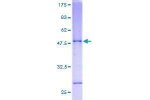 Image no. 1 for Selenoprotein S (SELS) (AA 1-189) protein (GST tag) (ABIN1319457)
