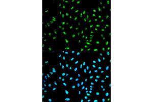 Immunofluorescence analysis of HeLa cell using NCF2 antibody. (NCF2 anticorps  (AA 227-526))