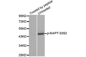 Western blot analysis of extracts from mouse brain tissue using Phospho-MAPT-S262 antibody (ABIN2988151). (MAPT anticorps  (pSer262))