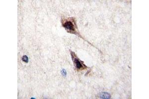 IHC analysis of FFPE human brain tissue stained with MEF2C antibody