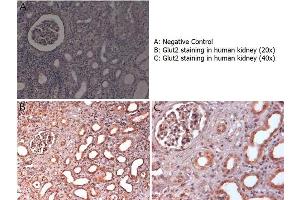 Immunohistochemistry with anti-Glut2 antibody showing Glut2 staining in nucleus and cytoplasm of ductal epithelium and of renal glomeruli in human kidney at 20x and 40x (B & C). (SLC2A2 anticorps  (C-Term))