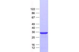Validation with Western Blot