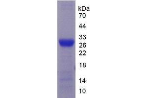SDS-PAGE analysis of Mouse CYP2E1 Protein.