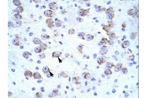 Image no. 1 for anti-Cation Channel, Sperm Associated 2 (CATSPER2) (AA 31-80) antibody (ABIN203121) (CATSPER2 anticorps  (AA 31-80))