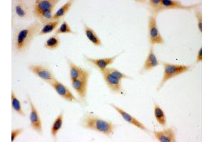 IHC analysis of BAK using anti-BAK antibody .