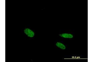 Immunofluorescence of purified MaxPab antibody to VDR on HeLa cell. (Vitamin D Receptor anticorps  (AA 1-427))