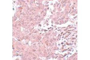 Immunohistochemistry (IHC) image for anti-Breast Carcinoma Amplified Sequence 3 (BCAS3) (N-Term) antibody (ABIN1031263) (BCAS3 anticorps  (N-Term))