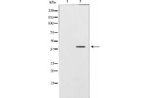 Western blot analysis on SK-OV3 cell lysate using NRG1 isoform-10 Antibody,The lane on the left is treated with the antigen-specific peptide. (Neuregulin 1 anticorps  (N-Term))