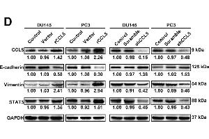 STAT3 is identified as the primary gene responsive for CCL5 stimulation on prostate cancer cells.