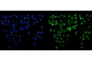 IF analysis of ATF6 using anti-ATF6 antibody (ABIN7601704). (ATF6 anticorps  (AA 423-670))