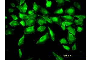 Immunofluorescence of monoclonal antibody to ACY1 on HeLa cell. (Aminoacylase 1 anticorps  (AA 1-408))