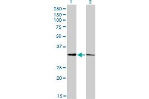 Western Blot analysis of CRSP8 expression in transfected 293T cell line by CRSP8 monoclonal antibody (M01), clone 8B8. (MED27 anticorps  (AA 1-70))